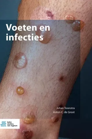 Voeten en infecties Gratis Verzending