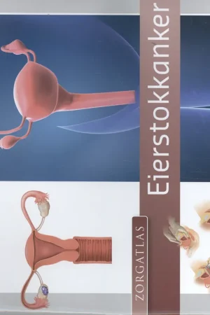 Zorgatlas Eierstokkanker Shop Nu