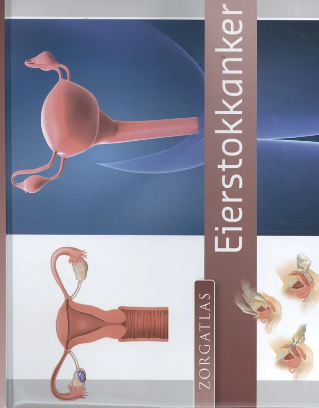 Zorgatlas Eierstokkanker Shop Nu