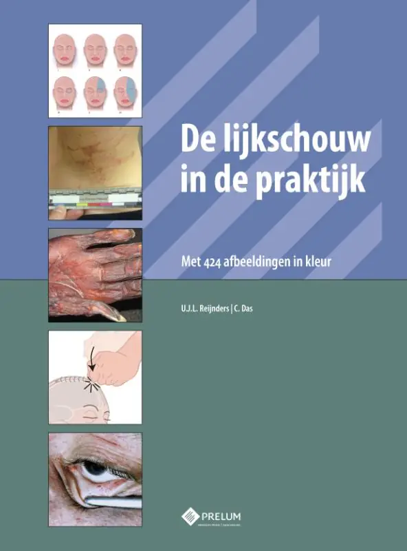 De lijkschouw in de praktijk Tijdelijk Beschikbaar
