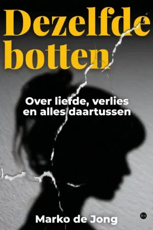 Rechtstreeks Van De Fabrikant Dezelfde botten